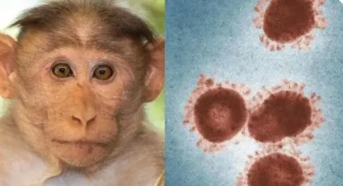 世卫组织：猴痘病毒已发生人际传播